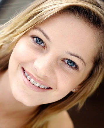 Clear Braces Holliston, MA, Adult Orthodontics